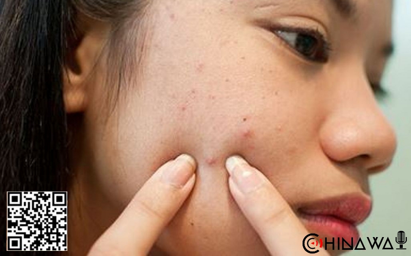 Девушка попала в больницу в критическом состоянии, выдавив прыщ на носу