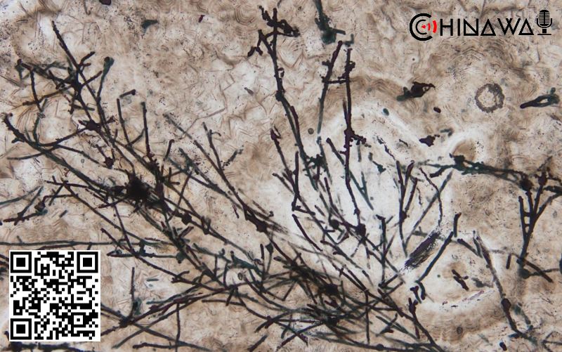 Гриб возрастом 635 миллионов лет нашли в Китае…